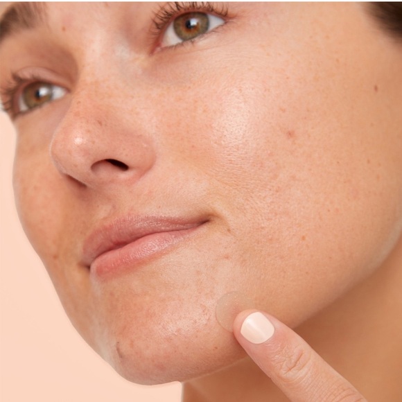 Peace out acne. NWT - Picture 11 of 13